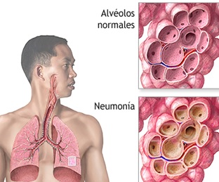 Bacteriologia