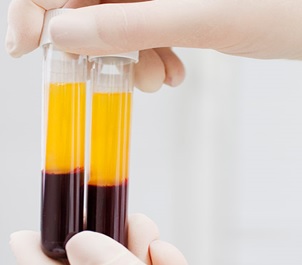 Hematología
